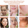 EMS МІКРОТОК MEDICA+ ЛІФТИНГ-МАСАЖЕР для обличчя SKIN LIFTING 6.0 PINK